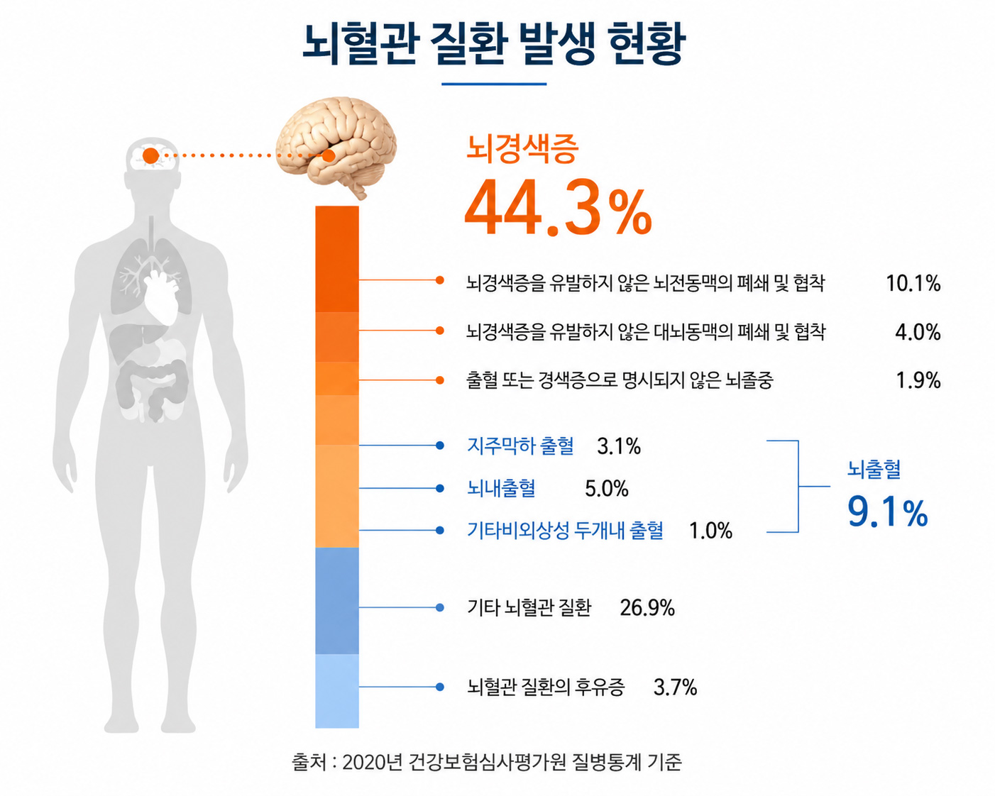 뇌혈관 질환 발생 현황