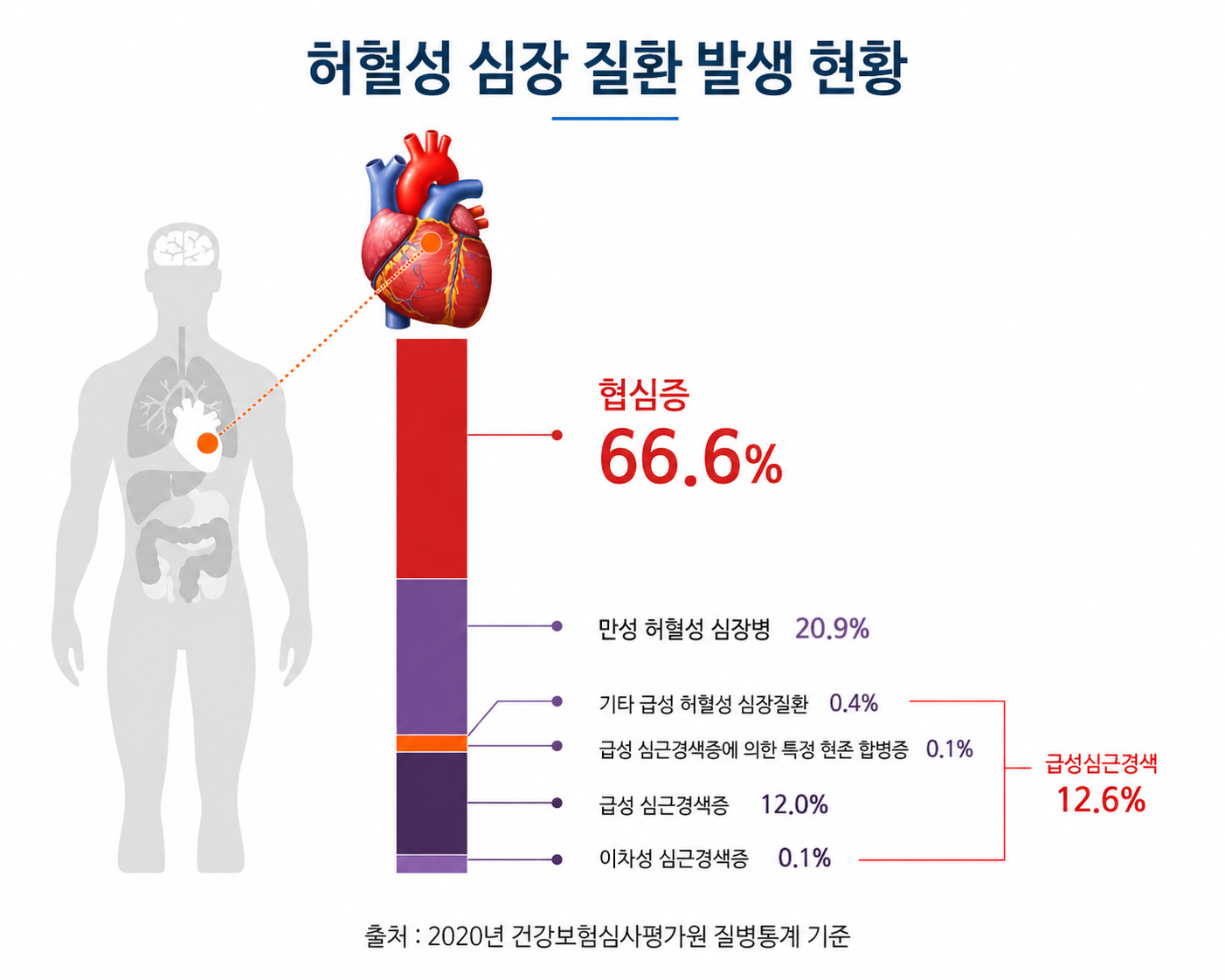 허혈성 심장질환 발생 현황